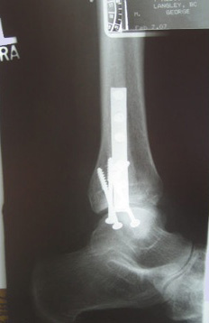 George's X-Ray